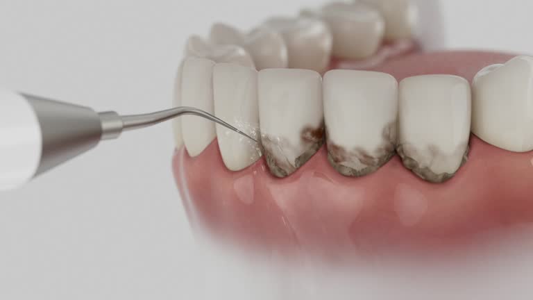 Trusted Tooth Extraction service in Mount Hope, WV - Dentist Open Now